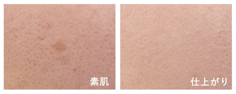 Before&After